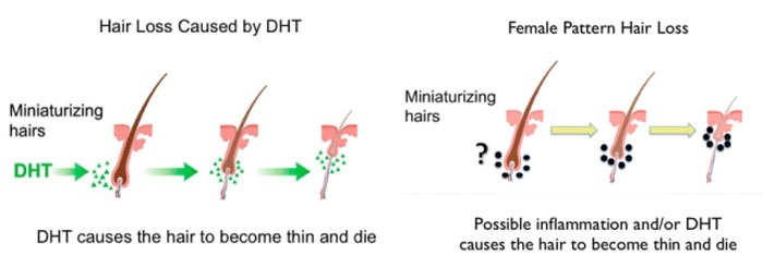 Common Causes of Hair Loss | TrichoStem Hair Regeneration Centers Common Causes of Hair Loss | TrichoStem Hair Regeneration Centers