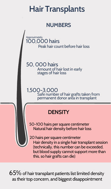 hair loss infographic