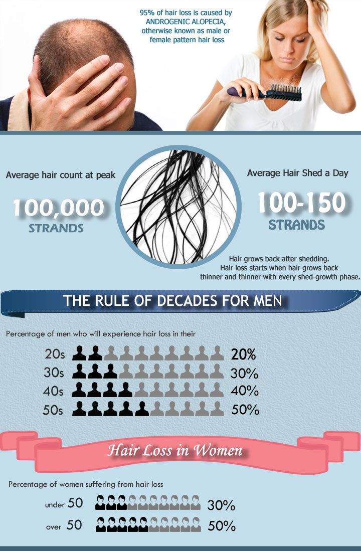 hair loss statistics infographic