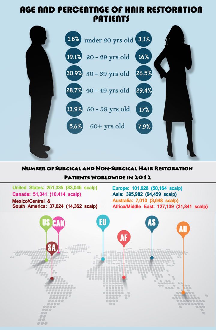 hair loss statistics infographic