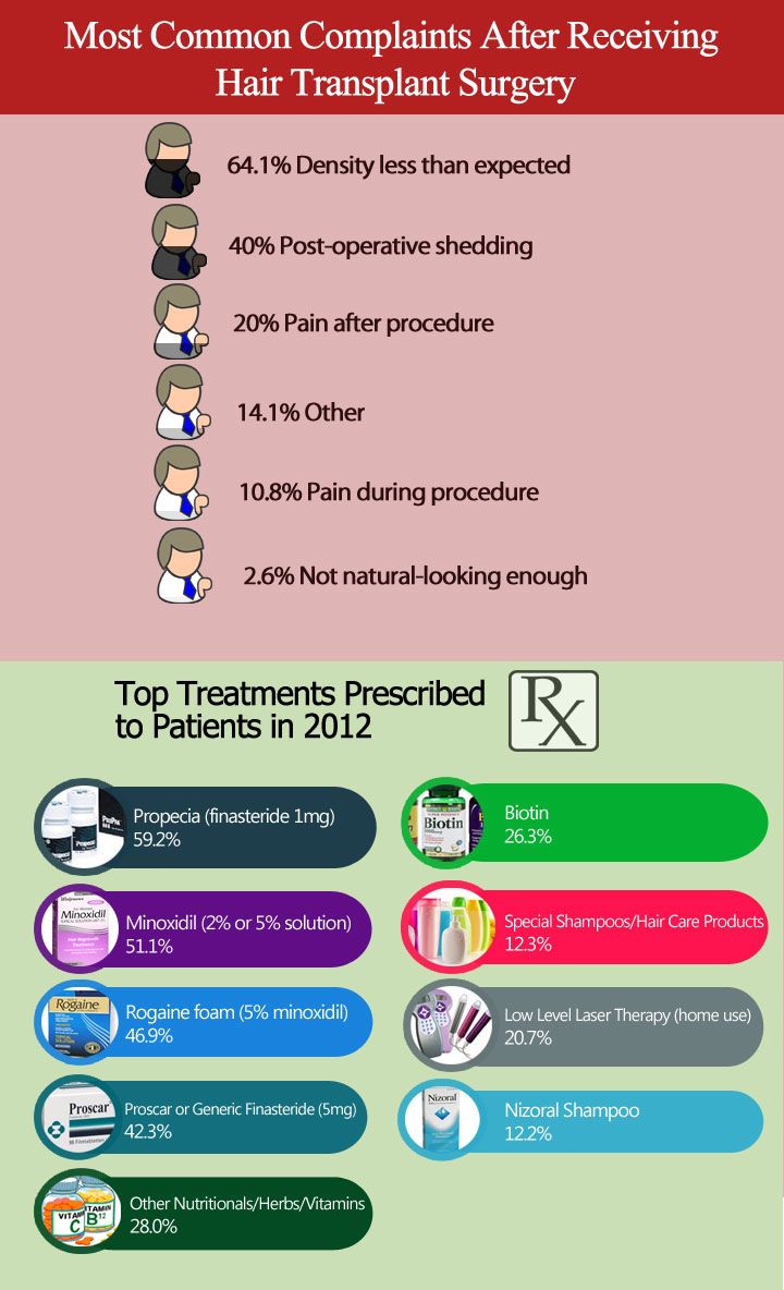 hair loss statistics infographic