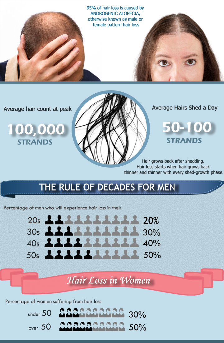 hair-statistics-infographic-part-1-2025-update hair loss statistics infographic 2025 update